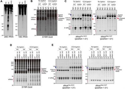 Selective Cleavage at CCA Ends and Anticodon Loops of tRNAs by Stress-Induced RNases